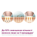 Фотоепілятор Philips Lumea Series 9900 BRI973/00